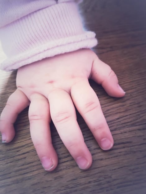 A close-up shot of a child's arm showing a visible bruise. The child's skin tone is light, making the bruise easily noticeable. The background is blurred, focusing attention on the injury and invoking a sense of concern.