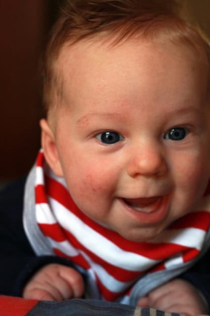 A picture of a baby's face with a mild rash around the mouth, indicating a possible allergic reaction to food. The baby is looking at the camera with a slightly irritated expression, while a parent's hand is gently wiping the rash. The image conveys concern and the need for careful monitoring of food reactions.