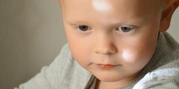 Understanding Baby Eczema: 2025 Treatments & Prevention Strategies - Cover Image